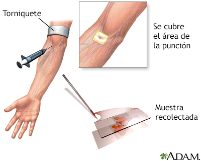 Procedimiento