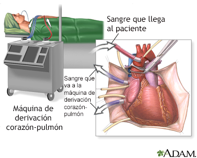 Procedimiento (primera parte)