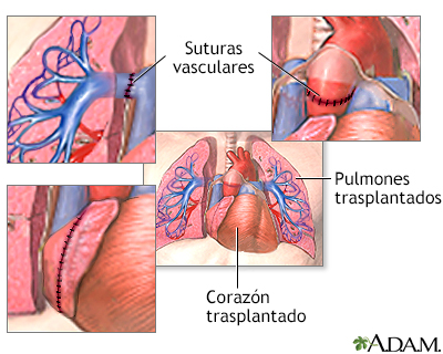 Procedimiento (segunda parte)