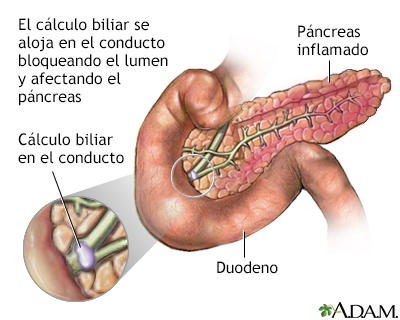 Indicaciones