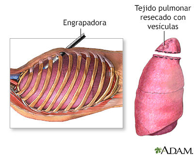 Cuidados postoperatorios