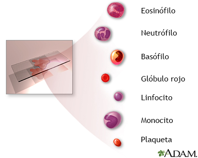 Indicaciones