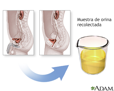 Procedimiento