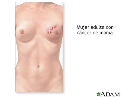 Indicaciones (primera parte)