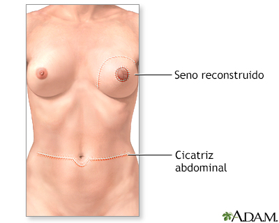 Cuidados postoperatorios