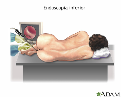 Cuidados postoperatorios