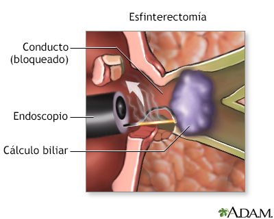 Procedimiento (segunda parte)