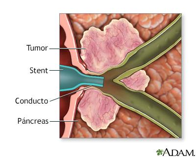 Procedimiento (tercera parte)