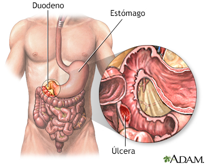 Indicaciones