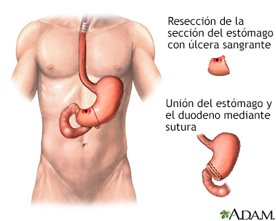 Procedimiento (tercera parte)