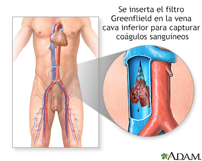 Procedimiento