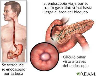 Procedimiento (primera parte)