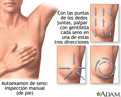 Autoexamen de seno