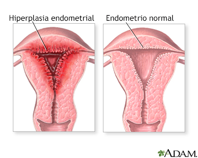 Periodos menstruales anormales