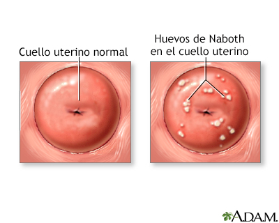 Huevos de Naboth