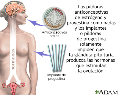 Anticonceptivos a base de hormonas