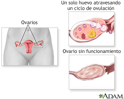 Factores de infertilidad