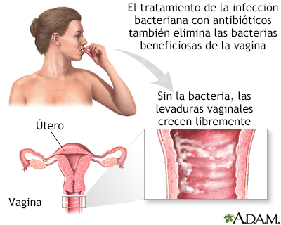 Infección secundaria