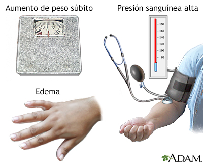 Preeclampsia