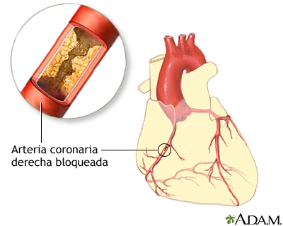 Indicaciones