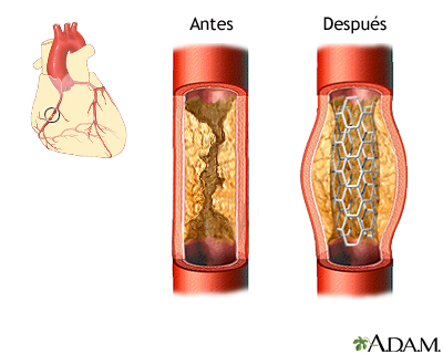 Cuidados postoperatorios (primera parte)