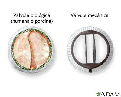 Procedimiento (segunda parte)