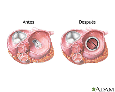 Cuidados postoperatorios