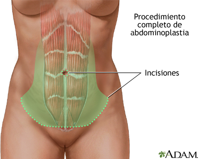 Procedimiento (primera parte)