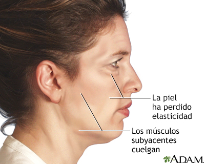 Indicaciones