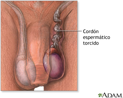 Indicación