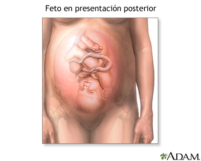 Presentación posterior