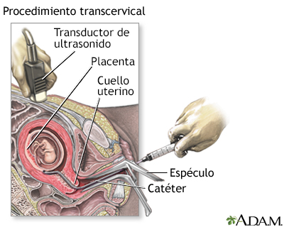 Prueba del vello coriónico