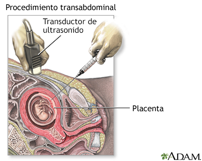 Prueba del vello coriónico