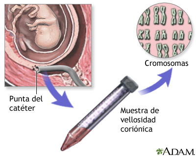 Prueba del vello coriónico