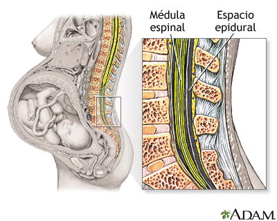 Procedimiento - Epidural 1