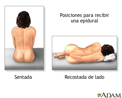 Procedimiento - Epidural 2