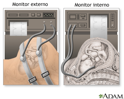 Procedimiento - Epidural 5