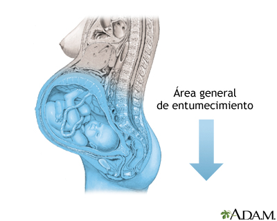 Procedimiento (sexta parte)