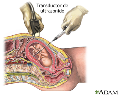 Procedimiento (primera parte)