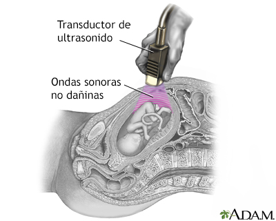 Ultrasonido