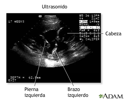 Ultrasonido 3