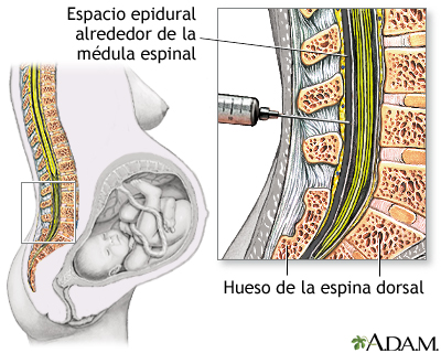 Procedimiento (primera parte)