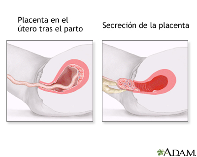 Procedimiento (séptima parte)