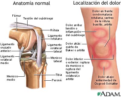 Knee pain