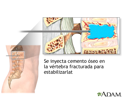 Procedimiento