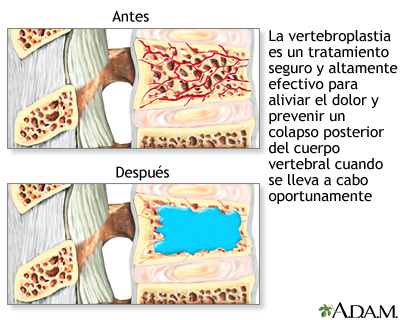 Tratamiento posoperatorio