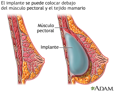 Procedimiento