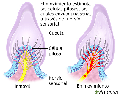 Vértigo