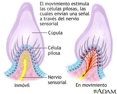 Vértigo