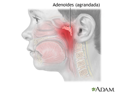 Indicaciones